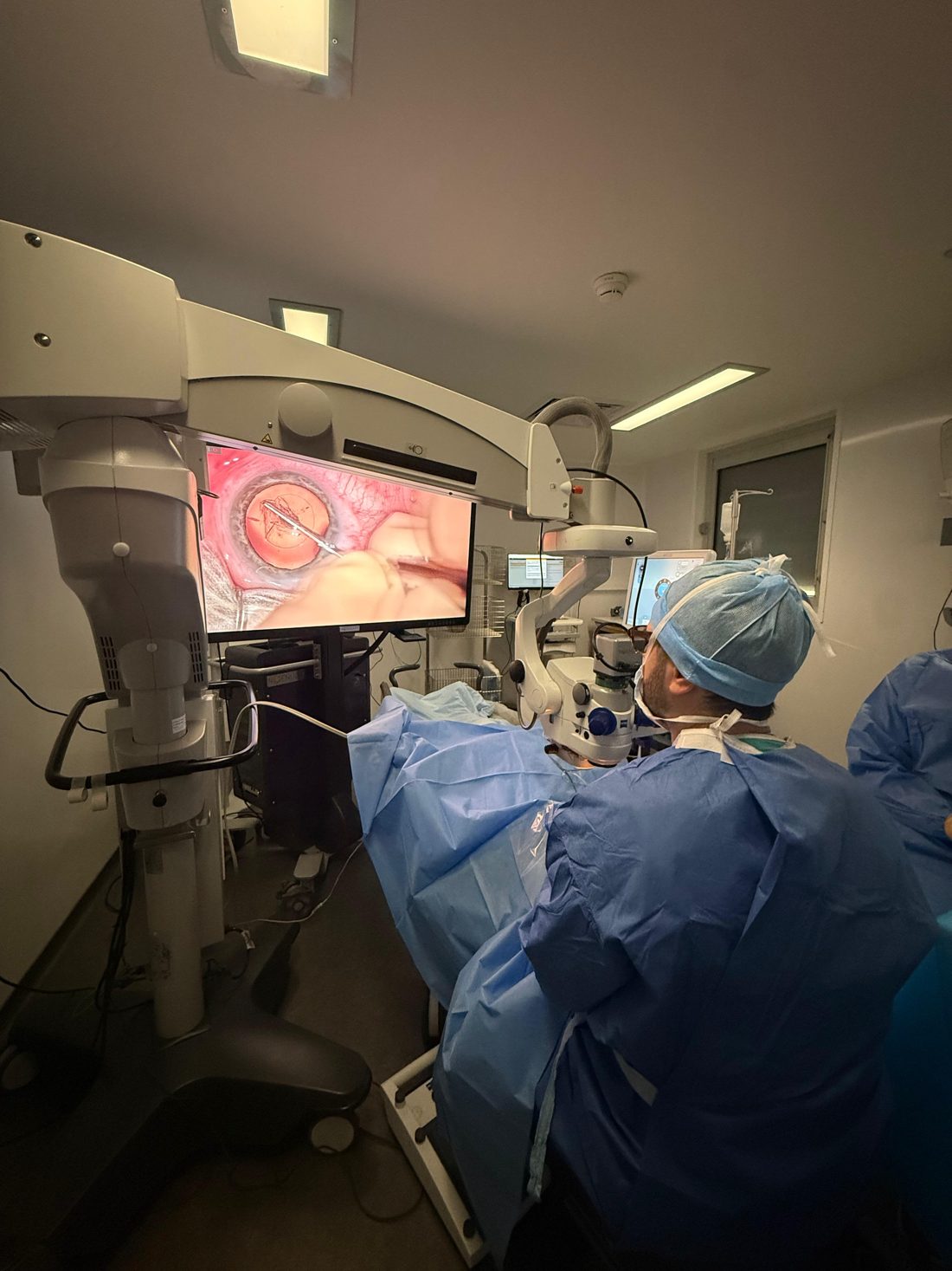 Le Dr Mamoun Berrada en chirurgie de la cataracte au microscope opératoire